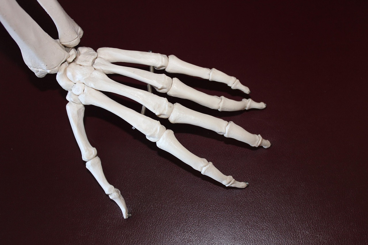 Human joint anatomy showing bones affected by gout